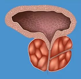 Segni caratteristici di prostatite